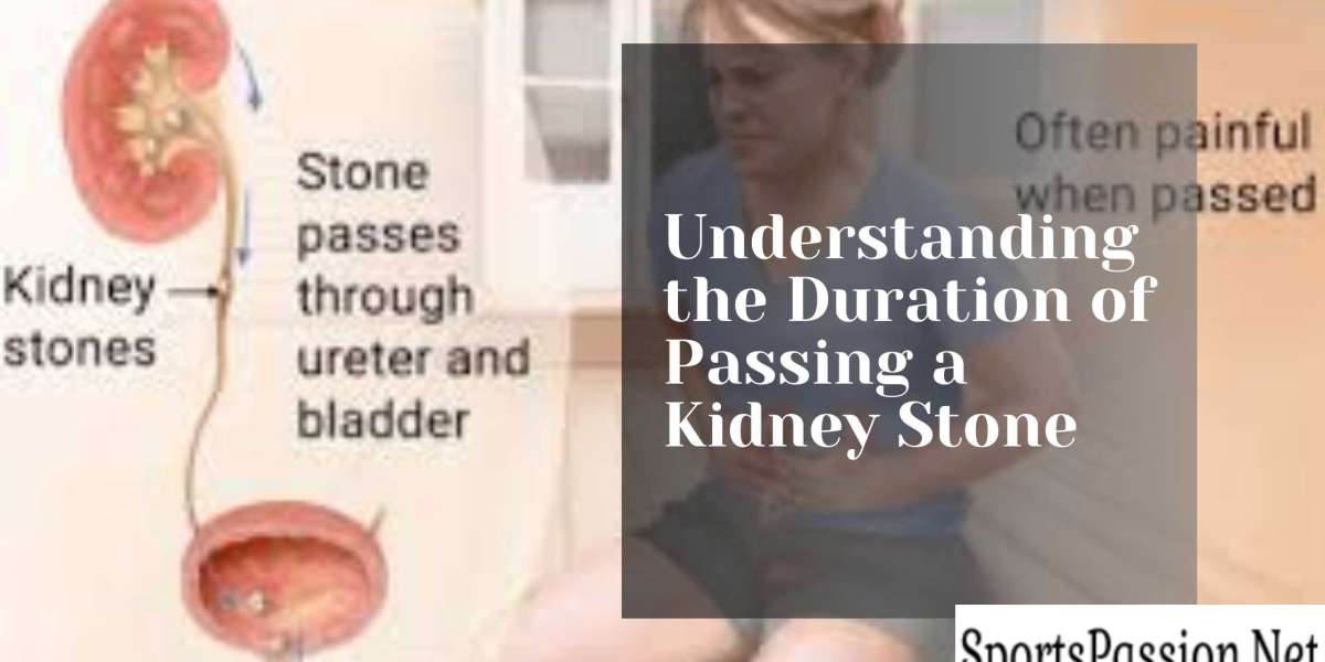 Understanding the Duration of Passing a Kidney Stone