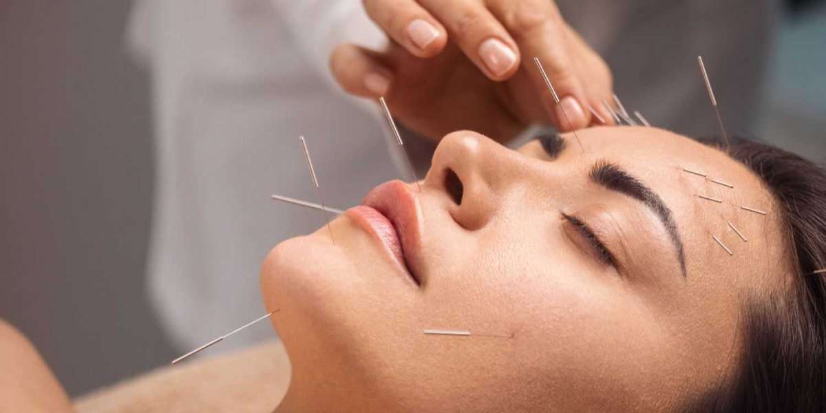 From Skeptic to Believer: My Acupuncture Therapy Journey
